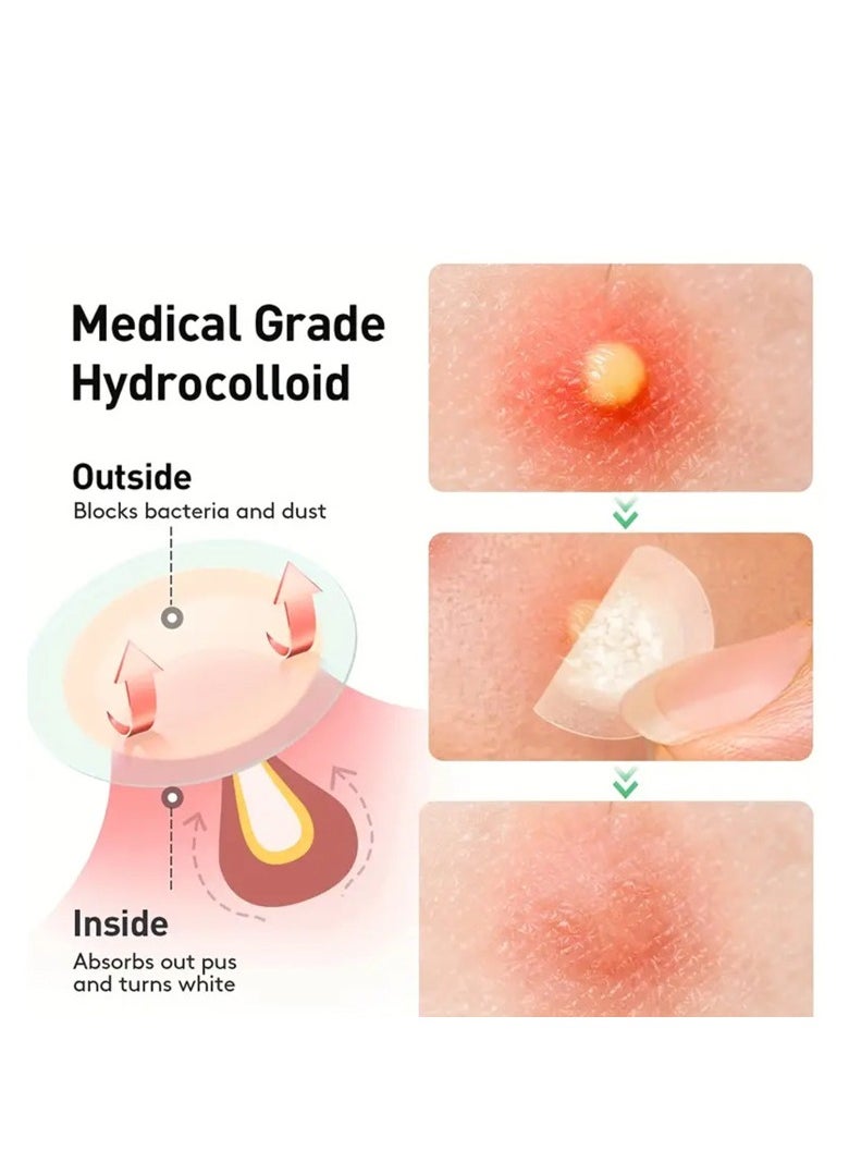 Acne patch - 288 Count Pimple Patch, Acne Covering Stickers For Face And Skin, For Men And Women Daily Skin Care - Image 1