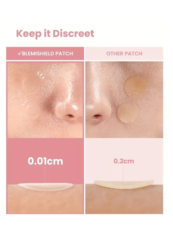 Acne patch - 288 Count Pimple Patch, Acne Covering Stickers For Face And Skin, For Men And Women Daily Skin Care - Image 1