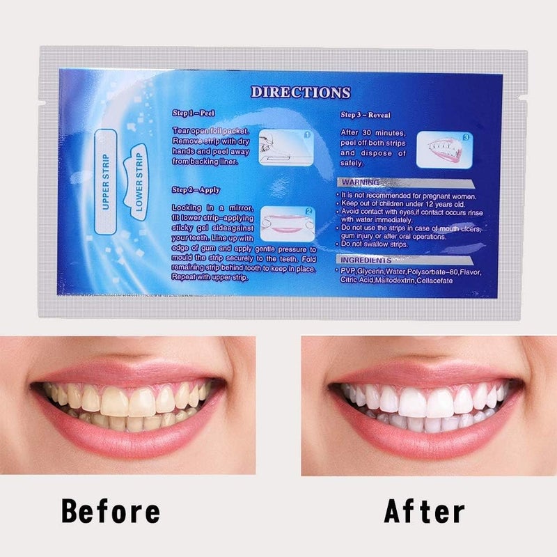 klarako Teeth Whitening Strip 28 White Stripes, White Stripe Teeth Whitening Strip, Professional Teeth Whitening Gel Strip Effective Teeth Care Kit, Teeth Whitening Strip - Image 2