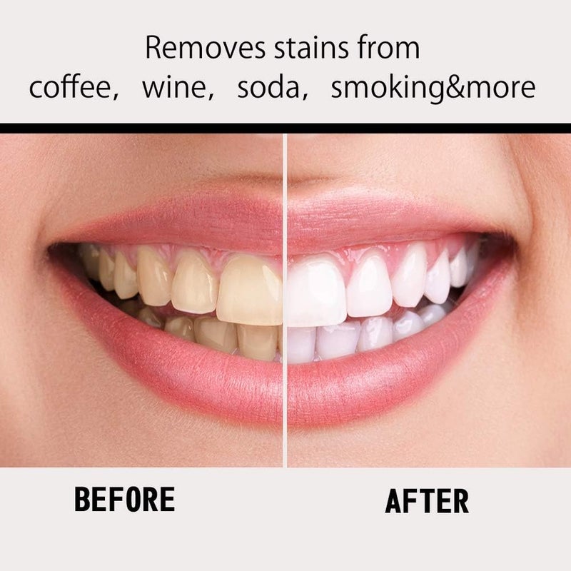 klarako Teeth Whitening Strip 28 White Stripes, White Stripe Teeth Whitening Strip, Professional Teeth Whitening Gel Strip Effective Teeth Care Kit, Teeth Whitening Strip - Image 4