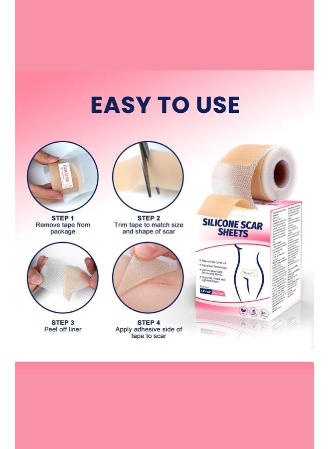 Sumifun Silicone Scar Sheets, Silicone Scar Tape Roll, Soft Silicone Gel Scar Tape, Medical Grade Silicone Scar Sheets, Scar Removal Strips for Acne Scars, C-Section Surgery Scars Treatment - Image 3