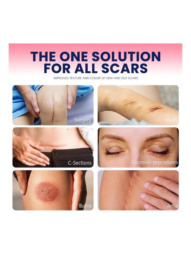 Sumifun Silicone Scar Sheets, Silicone Scar Tape Roll, Soft Silicone Gel Scar Tape, Medical Grade Silicone Scar Sheets, Scar Removal Strips for Acne Scars, C-Section Surgery Scars Treatment - Image 2