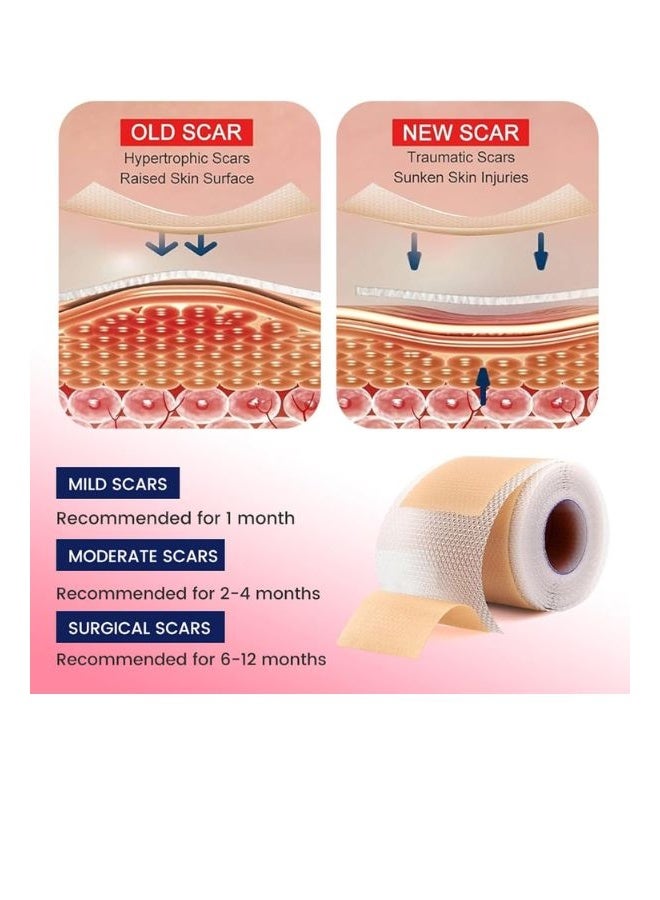Sumifun Silicone Scar Sheets, Silicone Scar Tape Roll, Soft Silicone Gel Scar Tape, Medical Grade Silicone Scar Sheets, Scar Removal Strips for Acne Scars, C-Section Surgery Scars Treatment - Image 5