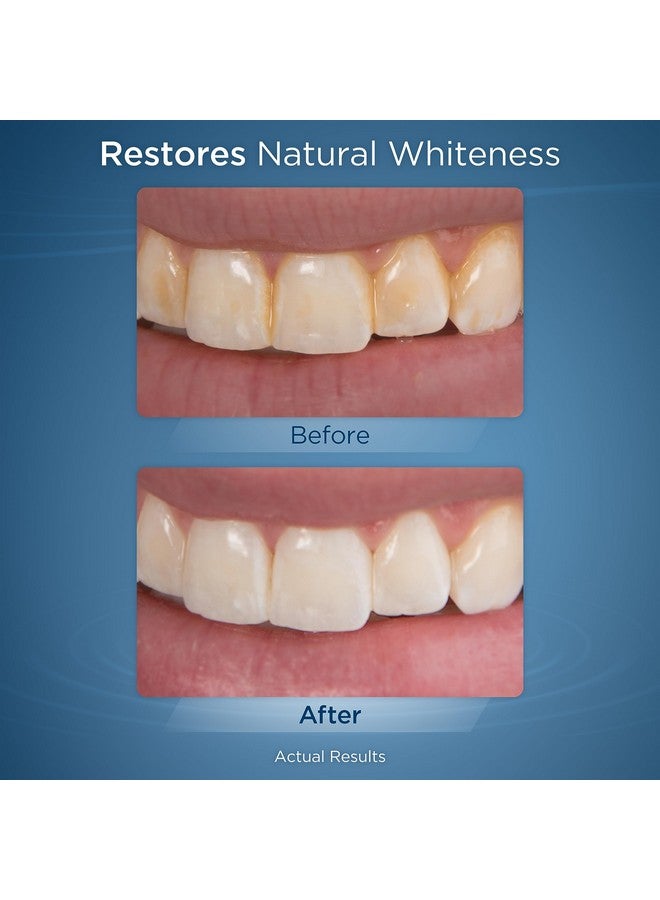 واتربيك أقراص Waterpik Fresh Mint Whitening Refill (30 قرصًا) - للاستخدام مع رأس Waterpik Boost أو جهاز Waterpik Whitening Water Flosser، قد تختلف العبوة، وزنها 30 غرامًا - Image 5