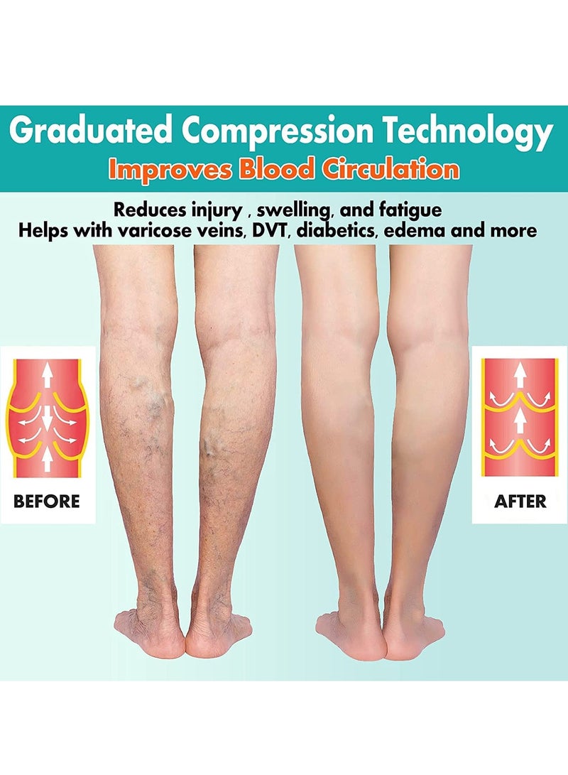 2 Pairs Compression Socks Open Toe Compression Stockings Knee High Socks with Zipper Compression Pantyhose 15-20mmHg for Improves Blood Circulation Prevents Leg Swelling (Beige) - Image 3