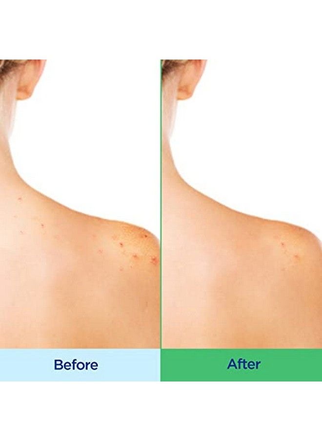 differin - Dailyoil Hydrating Cleanser | Face Wash | With Polyhydroxy Acids (Phas) | Oilfree Formula | 6 Oz. - Image 1