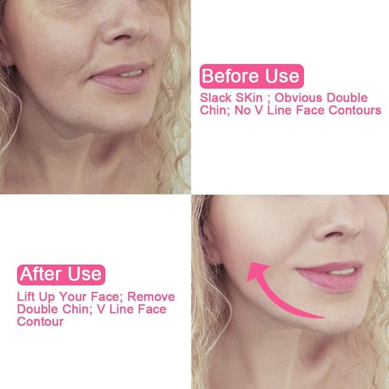 klarako Face Slimming Cheek Belt, Bandage Belt Mask Face-Lift Double Chin Skin Strap, Jaw Support Facial Lifting Strap Belt for V Face Line Slim - Image 2