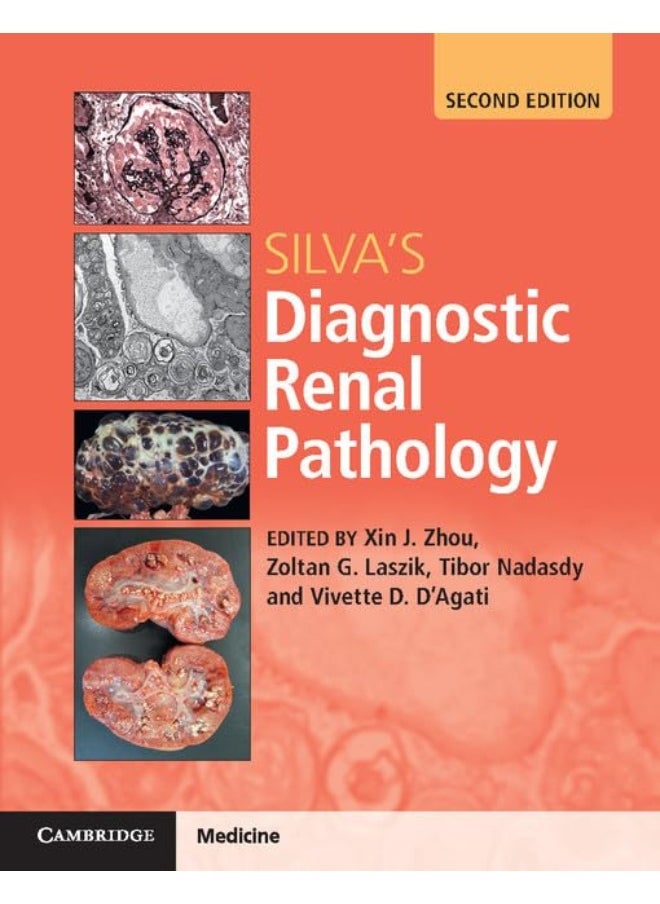 Silva's Diagnostic Renal Pathology 