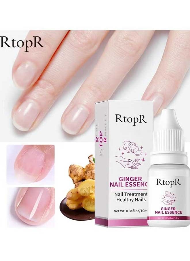 RtopR - Ginger Nail Repair Essence 10ml, Has Antifungal And Antibacterial Properties, Relieves Nail Infections, And Promotes Nail Healing, Nail Treatment Healthy Nails - Image 1