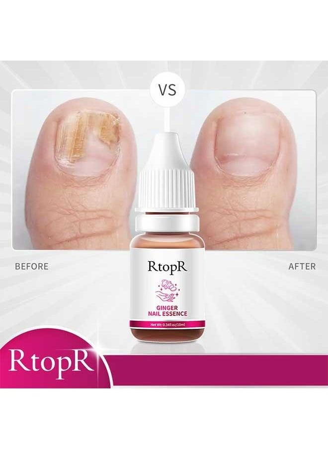 RtopR - Ginger Nail Repair Essence 10ml, Has Antifungal And Antibacterial Properties, Relieves Nail Infections, And Promotes Nail Healing, Nail Treatment Healthy Nails - Image 1