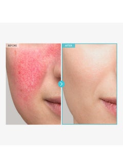 Tosowoong TOSOWOONG SOS Repair CICA Clinic Zinc Cream, 100,000ppm Zinc Oxide, Heal and Soothe Acne, Skin Barrier Repair, Moisture Barrier Cream, Non-Comedogenic, Korean Skincare, 50g, 1.76 oz.  - Image 3