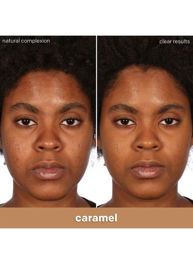 Almay - Clear Complexion Acne Foundation Makeup with Salicylic Acid - Lightweight, Medium Coverage, Hypoallergenic, Fragrance-Free, for Sensitive Skin, 800 Caramel, 1 fl oz. - Image 1