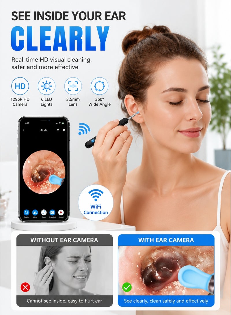 PGG Earwax Removal Visual Ear Pick Wireless Wifi Endoscope HD Ear Pick Wi-Fi Visible Earwax Removal Spoon for iPhone, iPad, Android Phone - Image 2