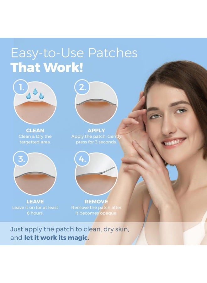 MEDca Acne Patches for Face - Hydrocolloid Bandages (56 Count) Pimple Patches for Face in Hearts & Stars, Acne Spot Treatment Care for Face & Skin Spot Patch Conceals Zits, Acne and Blackheads - Image 3