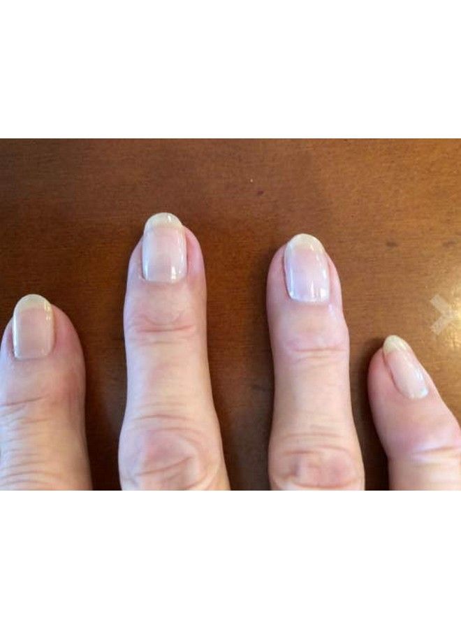 karma organic Deep Nutrition Nails Strengthener & 7 In 1 Elixir Nail Treatment Makes Your Nails Stronger And Healty - Image 4