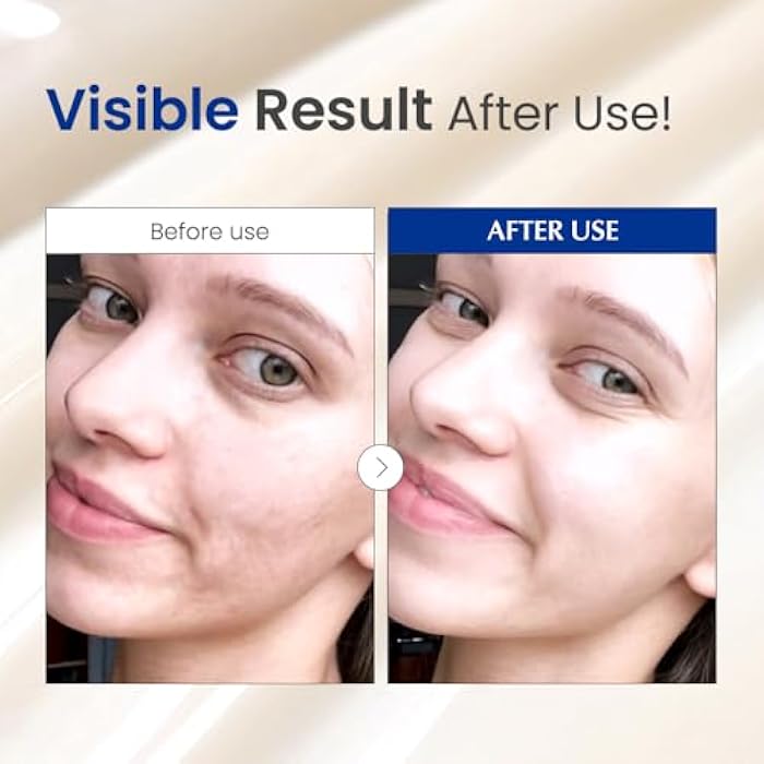 Dr. G Black Snail Retinol Ampoule - Korean Skincare with Snail Mucin - Advanced Retinol Face Ampoule for Glowing Skin - Anti Aging - Pore Minimizer for Fine Lines & Even Skin Tone Support - 1.69 fl oz - Image 5