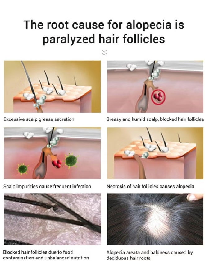 PURC Hair Essence Oil – Ginger Extract Formula for Hair Growth & Scalp Nourishment – Strengthens Roots, Reduces Hair Fall – 30ml - Image 4