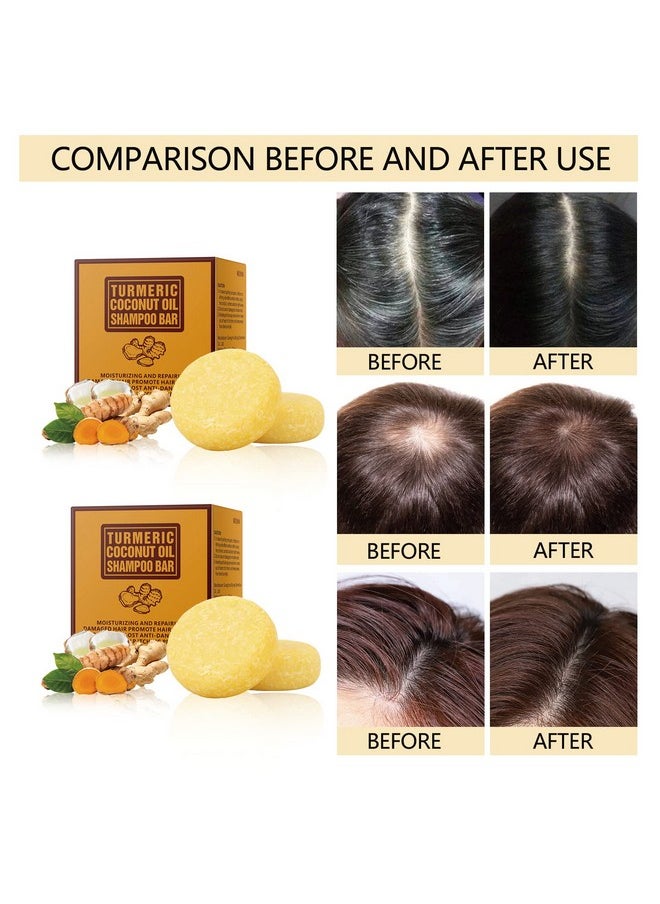 Tamoskiny - 2 Pack Ginger Hair Regrowth Shampoo Bar Turmeric Shampoo Bar Soap With Coconut Oil Natural Organic Ginger Bar Shampoo For Hair Growth Solid Ginger Shampoo Bar Promotes Hair Growth 120G - Image 1