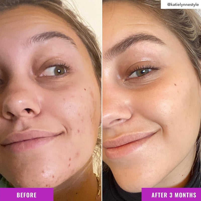 Good Molecules Niacinamide Brightening Toner - 4 OZ - Image 5