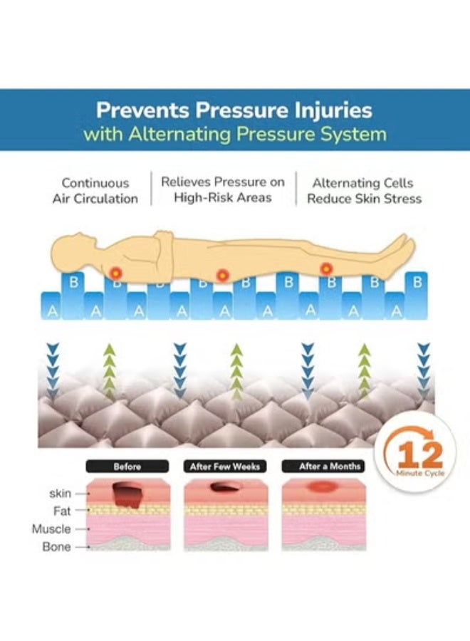 [مرتبة الهواء الفقاعية الطبية للمرضى] - سرير مضاد لقرح الفراش - إمداد طبي عملي بضمان استبدال - Image 3