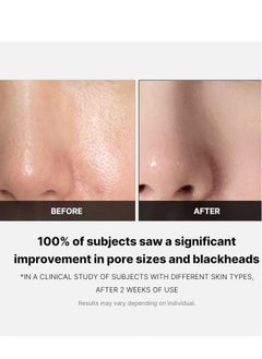 Medicube Medicube Zero Pore Pads 2.0 - Dual-Textured Facial Toner Pads for Exfoliation and Minimizing Pores with 4.5% AHA Lactic Acid & 0.45% BHA Salicylic Acid - Ideal for All Skin Types - Korean Skin Care  - Image 5