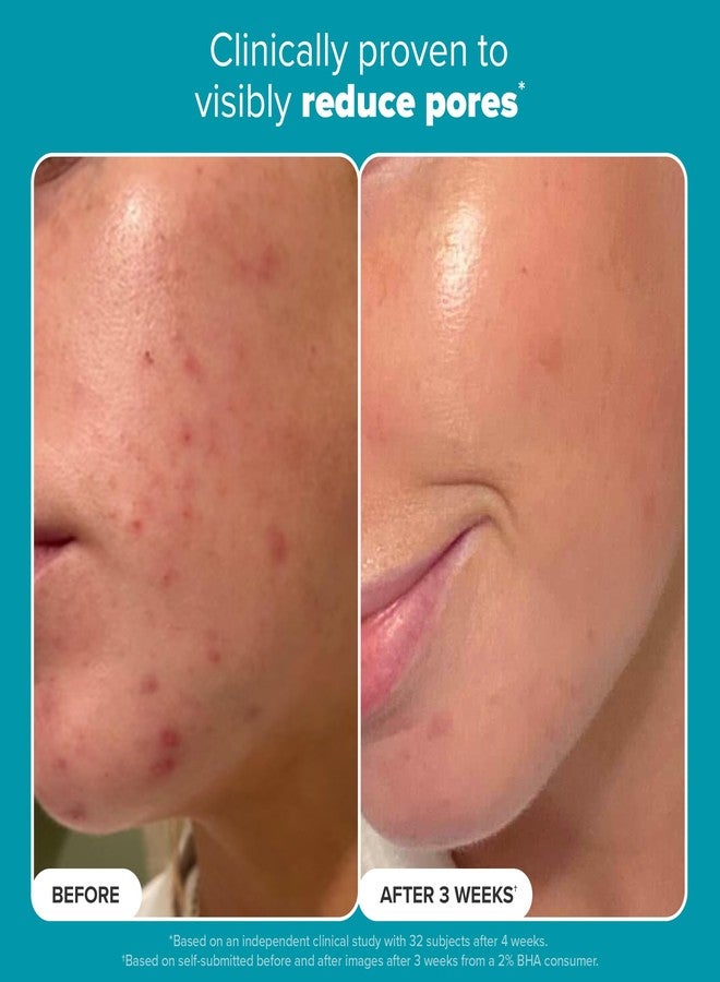 PAULA'S CHOICE مقشر سائل باولا تشويس 2% BHA، وسادات تونر مقشر حمض الساليسيليك، مقشر للوجه للمسام الواسعة، التجاعيد والخطوط الدقيقة ومناسب للبشرة المعرضة للرؤوس السوداء، 10 قطع - Image 4