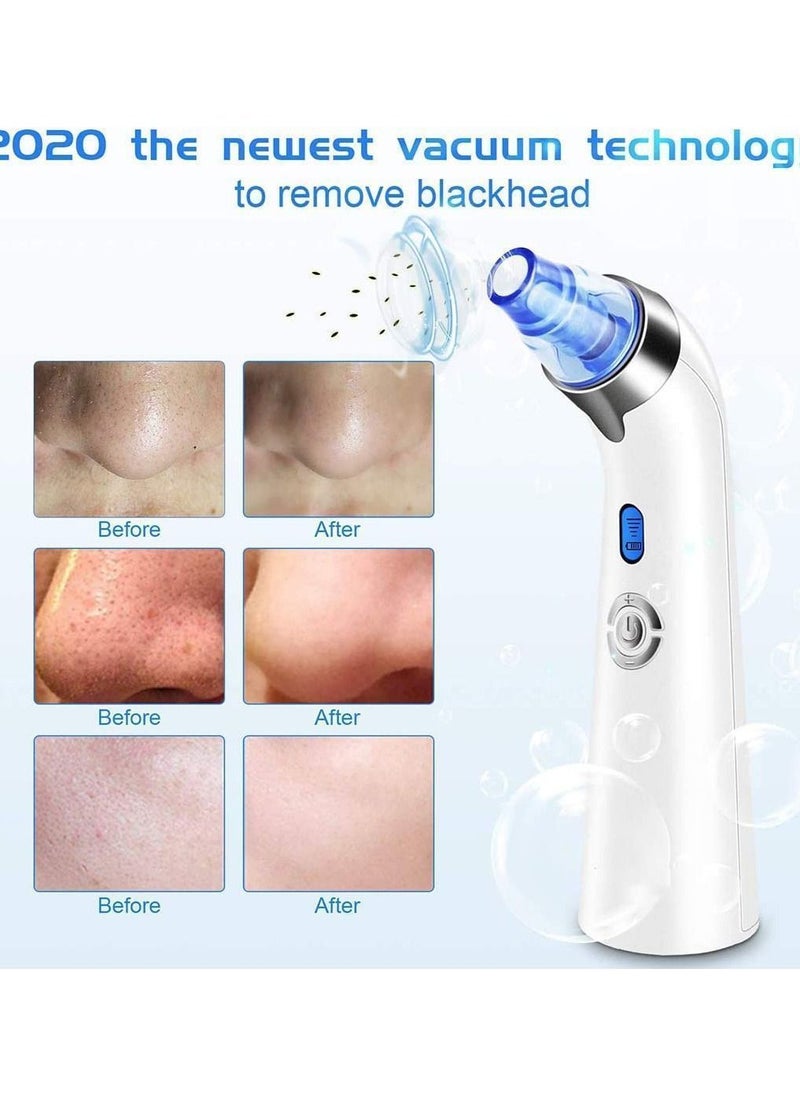 Y&D - Blackhead Remover Vacuum - Facial Pore Cleanser Electric Acne Extractor Kit USB Rechargeable Suction Tool with LED Display for Skin(Blue) - Image 1