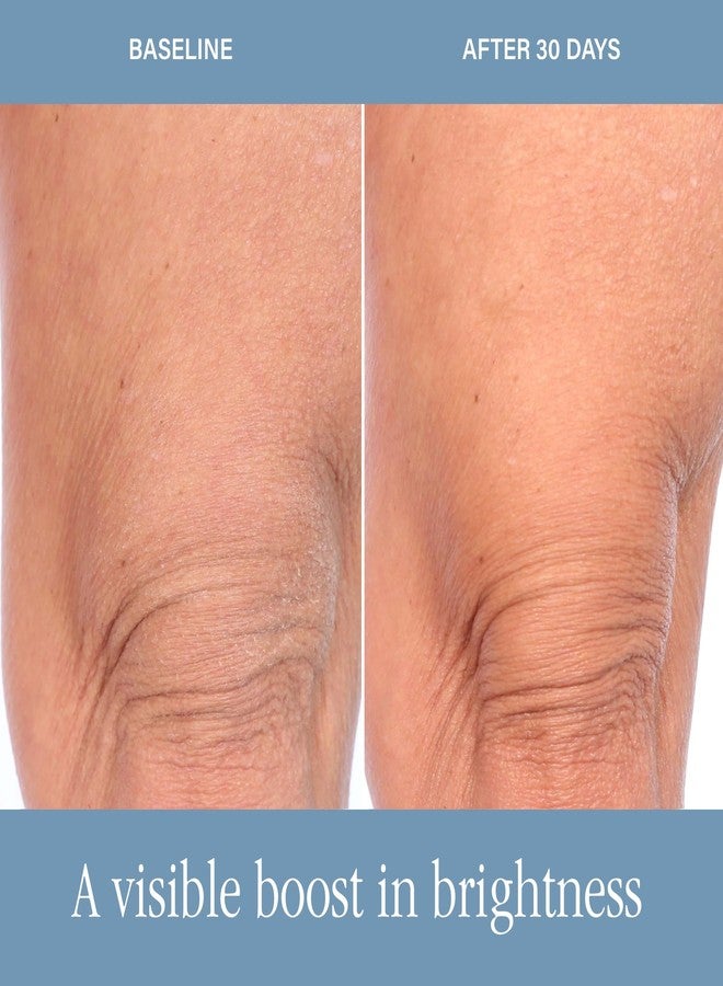 SKINN Dermappeal Body Scrub - Image 5