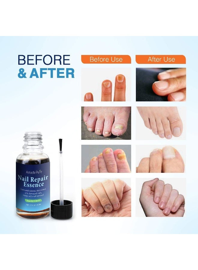 Amada Pure Nail Repair Essence - Image 5