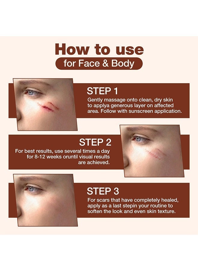 HY Silicone Scar Stick, 60% Silicone Scar Solutions for Face and Body, with Centella Asiatica & Vitamin E, Soothing & Moisturizing Scar Treatment for Old & New Scars - Image 5