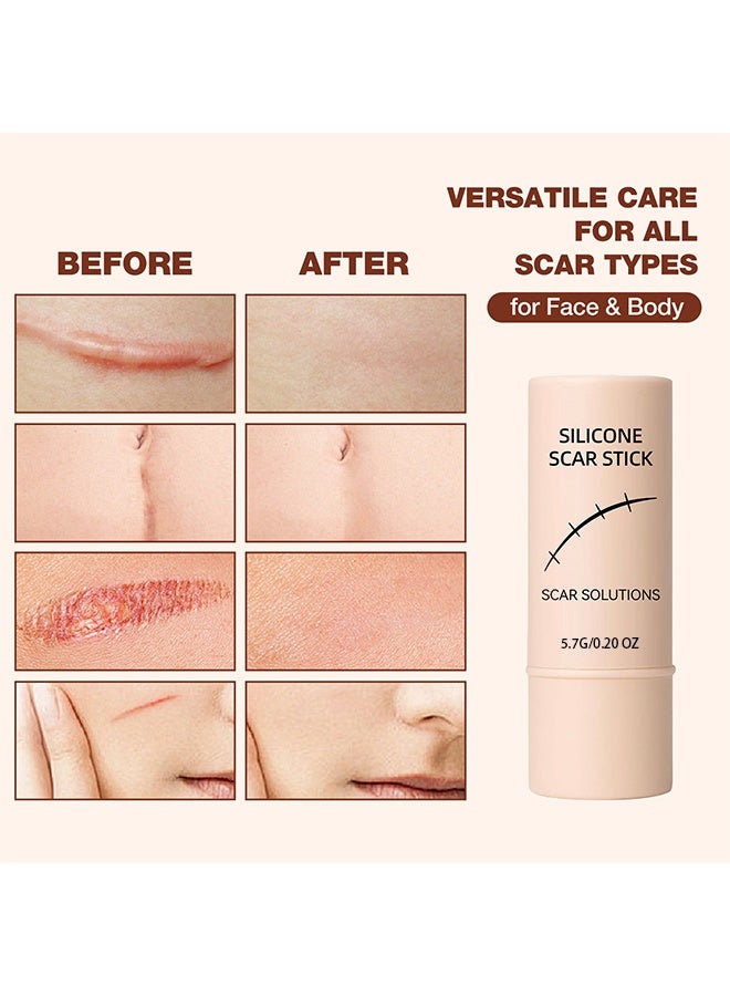 HY Silicone Scar Stick, 60% Silicone Scar Solutions for Face and Body, with Centella Asiatica & Vitamin E, Soothing & Moisturizing Scar Treatment for Old & New Scars - Image 4