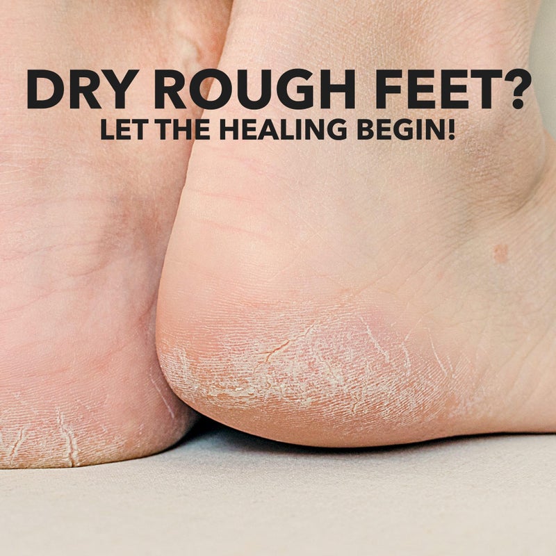 Adamia Therapeutic Repair Foot Cream with Pure Macadamia Oil, 4 Ounce Tube - Fragrance Free, Paraben Free, Non GMO - Image 3