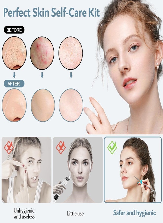 MENOLY Blackhead Remover Tools MENOLY 10Pcs Pimple Popper Tool Kit, Blackhead Remover Extractor Tools, Acne Kit for Blackhead,Blemish,Zit Whitehead and Comedone Extractor Tool with Leather Bag - Image 2