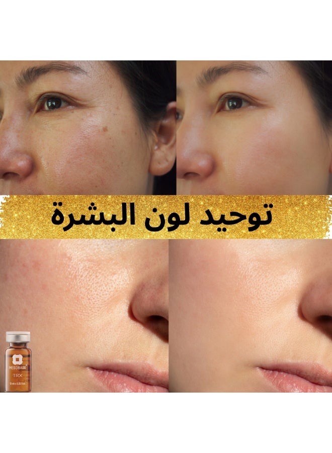 MESOBASE mesotherapy Tranexamic 10% for melasma dark spots unifying skin tone reducing acne scars brightening and refreshing the skin (one 10ml pack) - Image 3