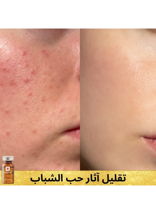 MESOBASE mesotherapy Tranexamic 10% for melasma dark spots unifying skin tone reducing acne scars brightening and refreshing the skin (one 10ml pack) - Image 5