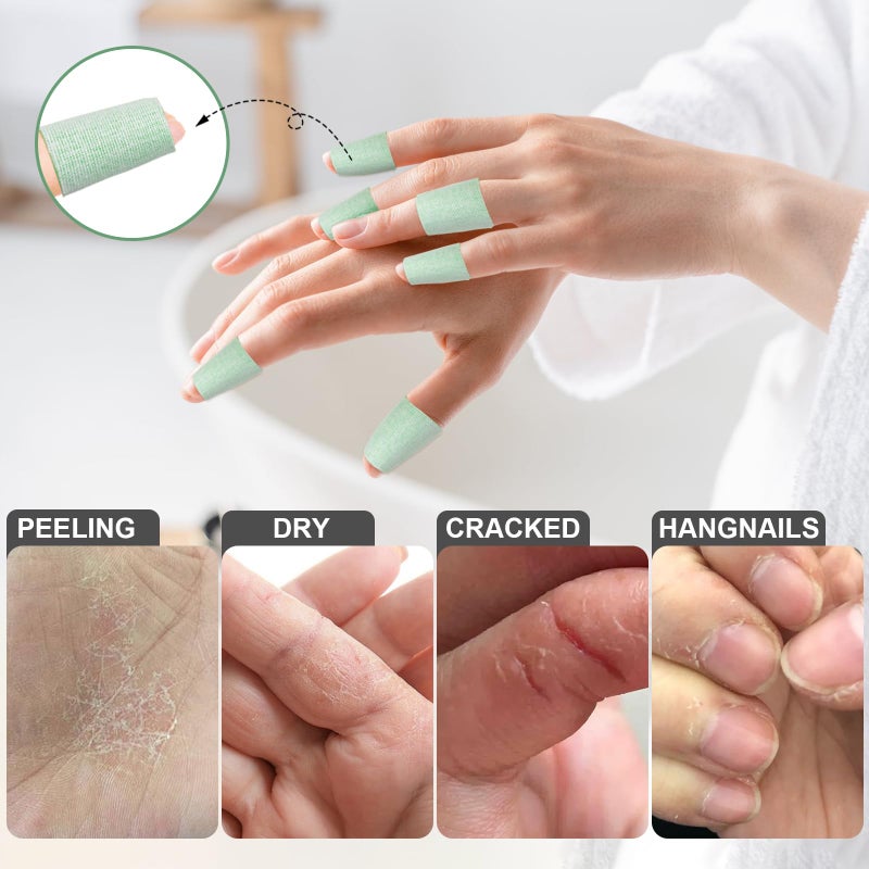 TEAWOO 50PCS Aloe Vera Cracked Hands Treatment Patches, Dry Cracked Hands Repair Bandage - Image 2
