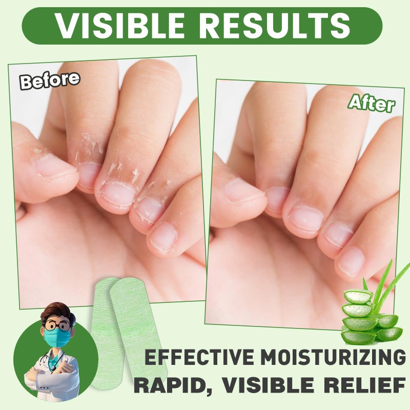 TEAWOO 50PCS Aloe Vera Cracked Hands Treatment Patches, Dry Cracked Hands Repair Bandage - Image 3
