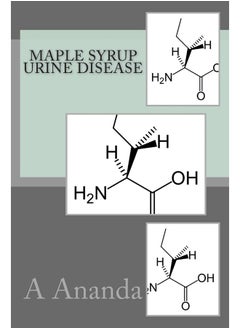 Maple Syrup Urine Disease - pzsku/ZB68E6778E58739E7EE3FZ/45/_/1726051259/0d9269b5-5689-4648-9f1a-54546ce276aa