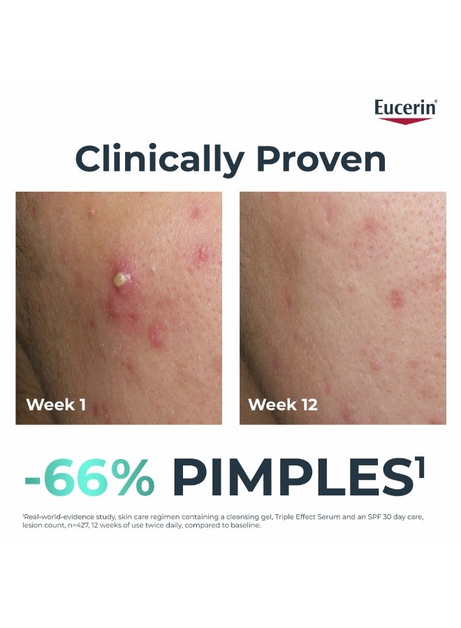 Eucerin ديرمو بيوريفير بعد - تقليل علامات العيوب، 40 مل - قد يختلف التعبئة - Image 2