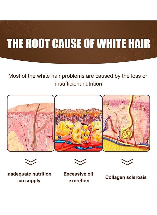 جايسوينغ Anti White Hair Essence ، مصل الشعر الداكن المضاد للشيب للرجال والنساء ، غميق طبيعي ، يعزز صحة الشعر وأكثر كثافة 30 مل - Image 4
