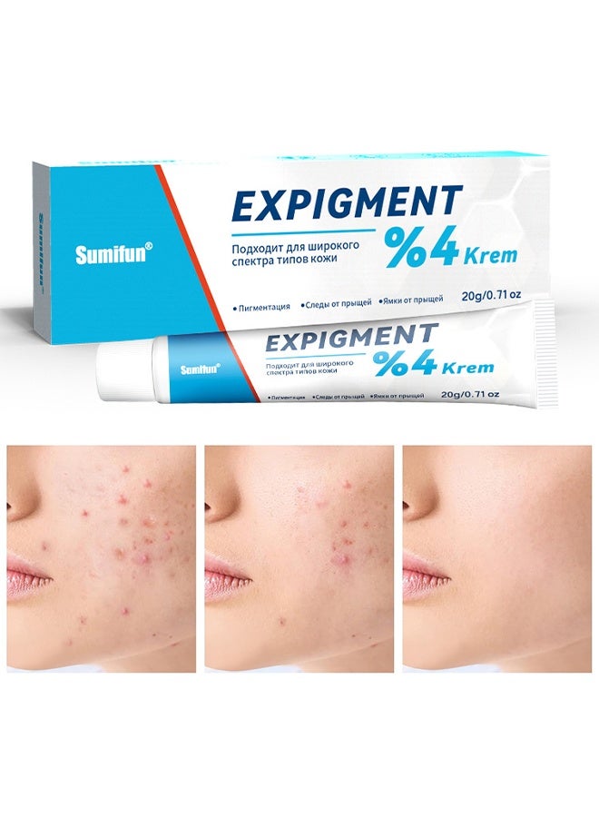 سوميفون كريم Expigment بنسبة 4%، للتحكم الدقيق في حب الشباب للوصول إلى جذور الحبوب - Image 1