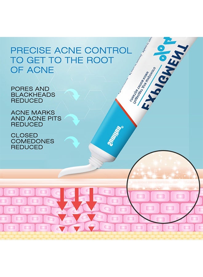 سوميفون كريم Expigment بنسبة 4%، للتحكم الدقيق في حب الشباب للوصول إلى جذور الحبوب - Image 4