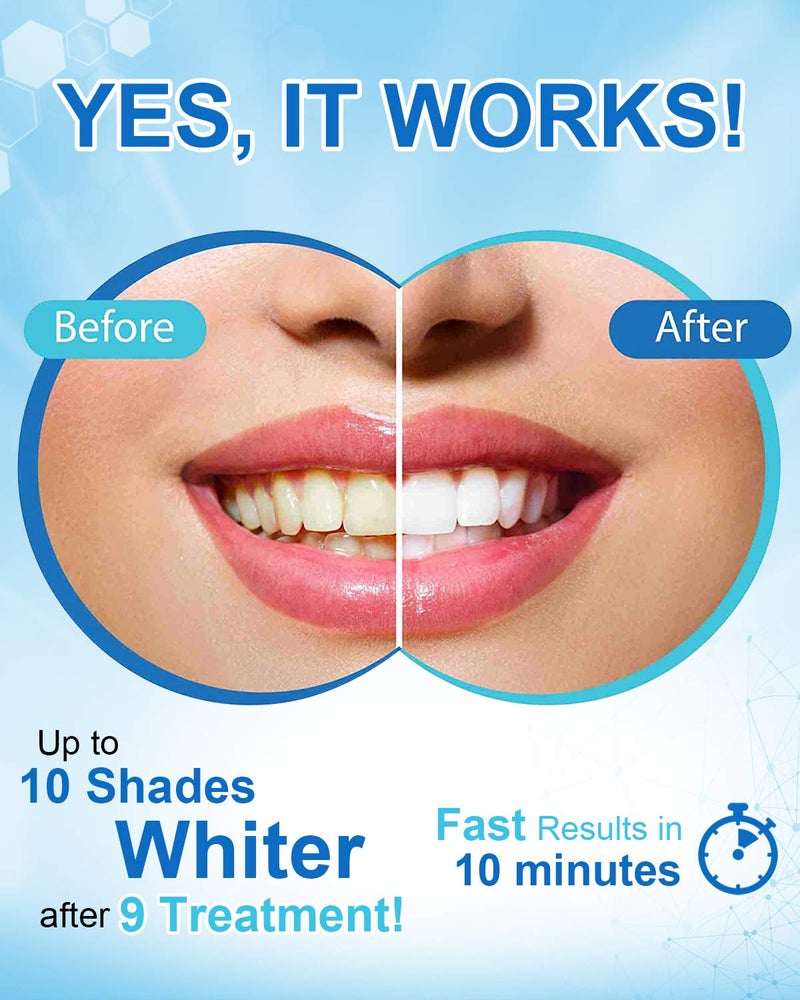 MySmile Non-Sensitive Teeth Whitening Pen Mint Gel Enamel Safety 8ML 30+ Treatments Fast Remove 20 Years of Stains Care Oral Bright Smile Alternative Teeth Whitening Strips ï»¿ - Image 4