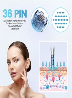دي آر. بن عبوة من 10 خراطيش إبرة قلم Dr.Pen Microneedle - متوافقة مع طرازات Dr.Pen A9 وA11 وA8S وM8S، قطع غيار يمكن التخلص منها مع حربة (36 إبرة)  - Image 3