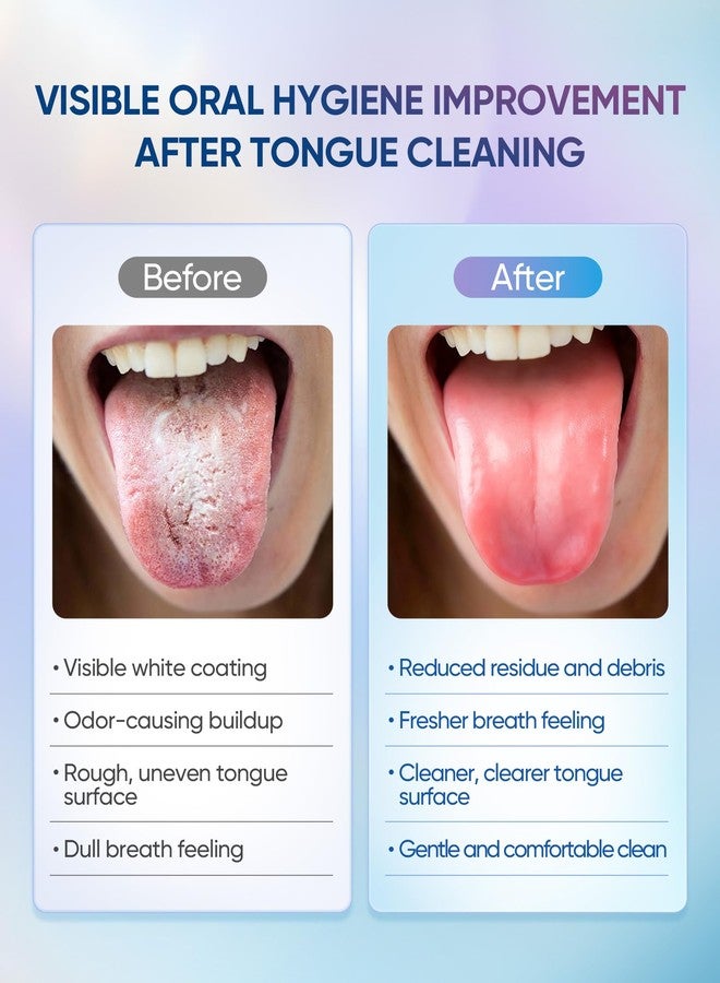 BodyAccel Tongue Cleaner Gel with Tongue Brush – Fresh Breath Oral Care Kit – Tongue Scraper Gel Set for Bad Breath Removal, Maintain Oral Health - Image 4