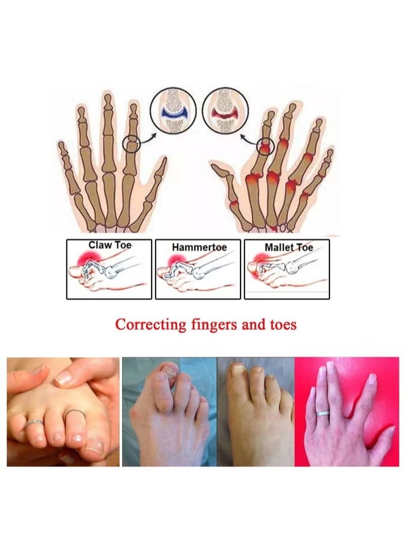 8-Piece Toe Splint Wraps Non Slip Hammer Straightener For Broken Crooked Overlapped And Toes-Women Men