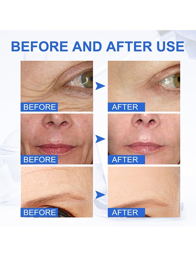 Sefudun - Botox Stock Solution，Botox Stock Solution for Lightens Fine Lines,Improves Nasolabial Folds,Anti-wrinkles-30ml - Image 1