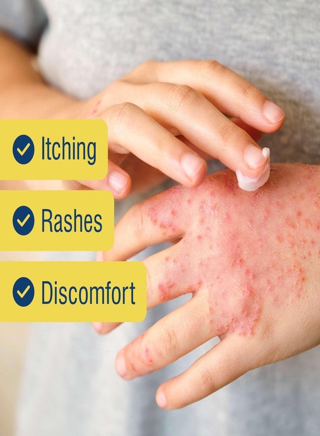 TenderGentle 1% Hydrocortisone Cream Maximum Strength - 1 oz of Anti Itch Cream for Itching and Rashes - for Eczema, Poison Plants, Insect Bites, and More - Image 4