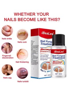 iBealee Nail Fungus treatment 7 Day Nail Repair Treatment Liquid for Damaged Toenails and Fingernails Fungal Nail Renewal Anti Fungus Nail Repair Smooth Moisturize Nail Reduce Discoloration Nail Serum 20ml  - Image 2