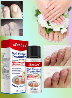 iBealee Nail Fungus treatment 7 Day Nail Repair Treatment Liquid for Damaged Toenails and Fingernails Fungal Nail Renewal Anti Fungus Nail Repair Smooth Moisturize Nail Reduce Discoloration Nail Serum 20ml  - Image 1